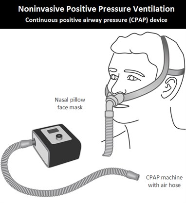 1-Image-CPAP device-Patient